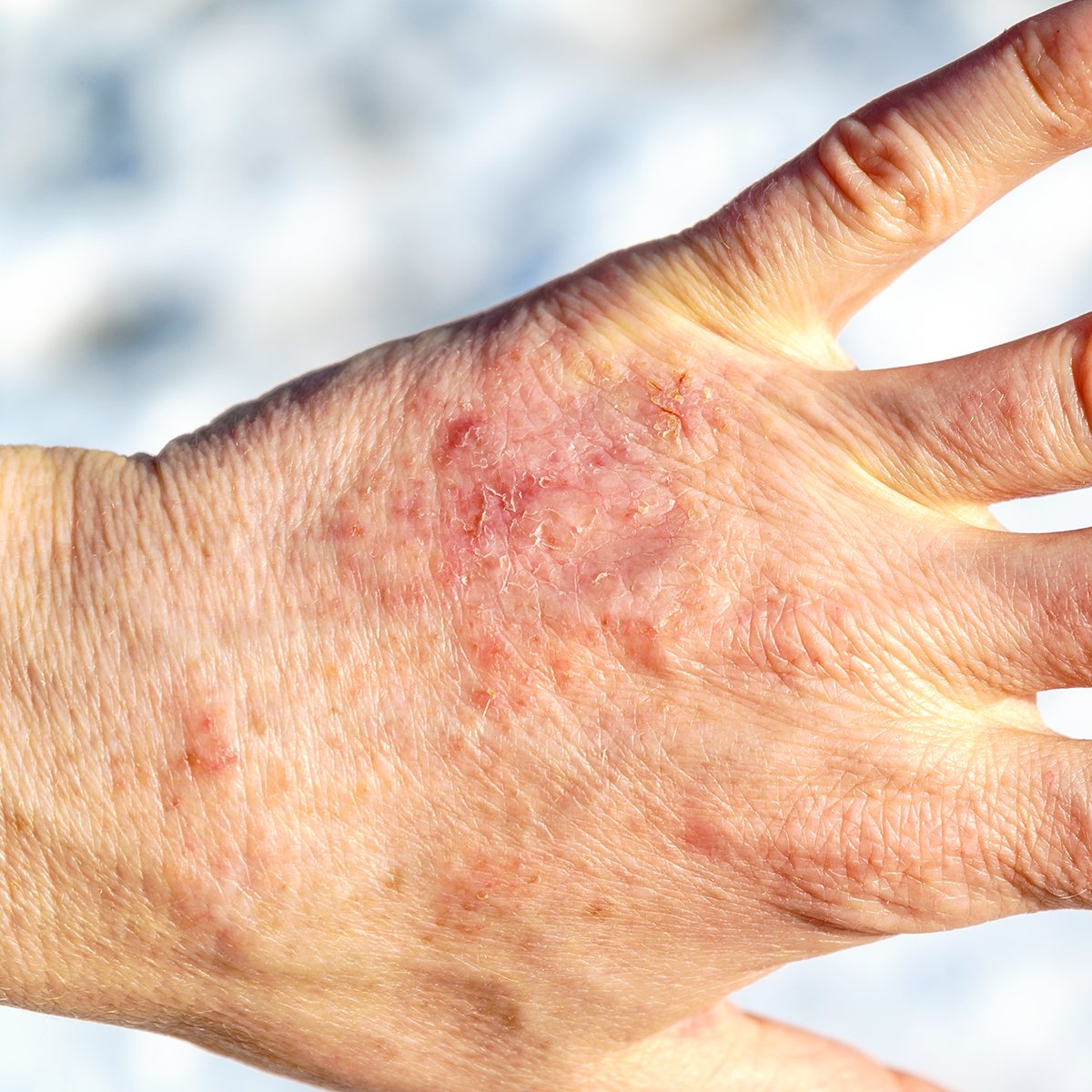 How to avoid dry hands in winter - O'Keeffe's top tips